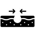 Reduction in pore size