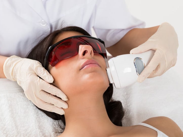 How Often Should You Get Laser Acne Rx?