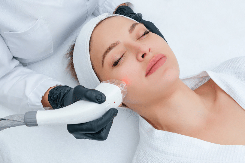 Understanding BBL Laser Treatment and Its Benefits