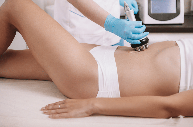 What to Expect During the MP2 Skin Tightening Procedure