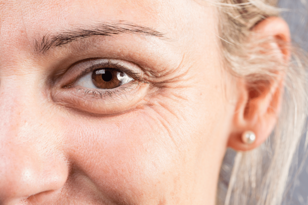 Crow's Feet and Eye Area Longevity