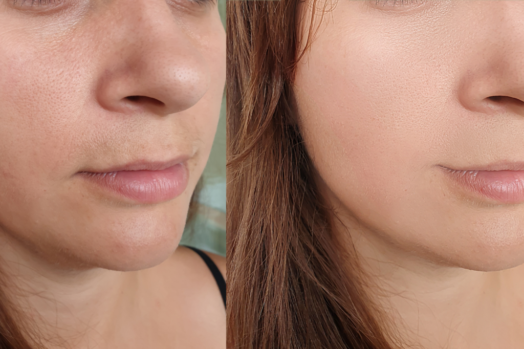 Spotting Quality Results vs. Overdone Treatments