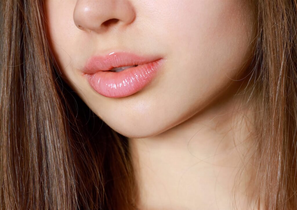 Young woman with enhanced lips after lip injections at Formula Wellness