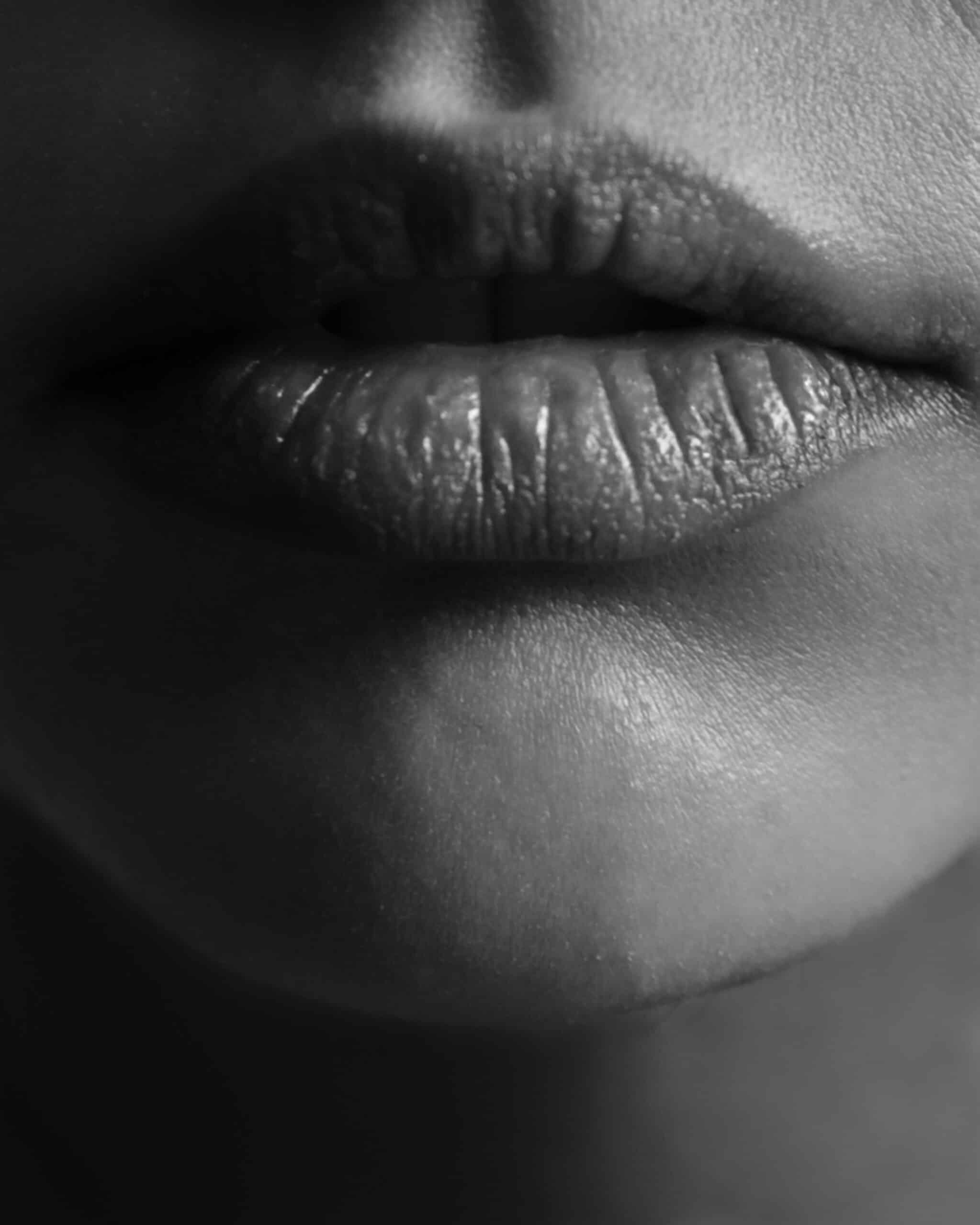 Full, smooth lips after lip injections at Formula Wellness, showing natural-looking volume and definition.